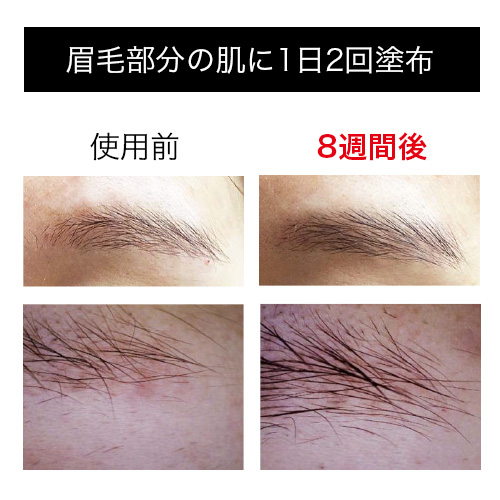 ペロバーム ブローブロー 10ml