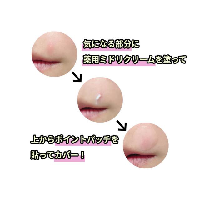 HINアクネスラボ ポイントパッチ 15枚入 小/大
