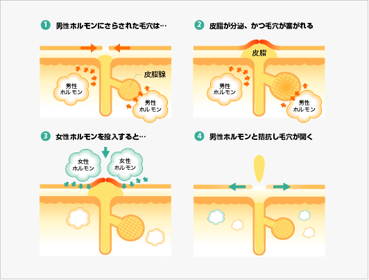 HINアクネスラボ アクアクリーム 40g