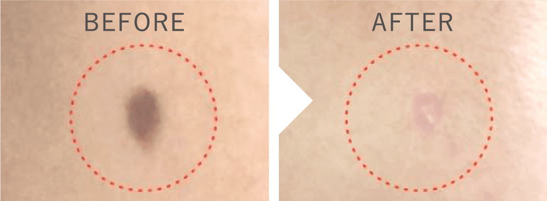 BEFORE AFTER