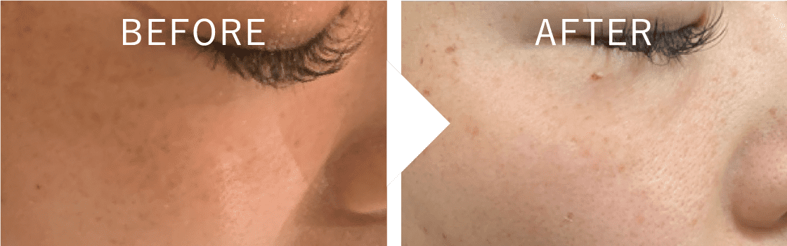 BEFORE AFTER
