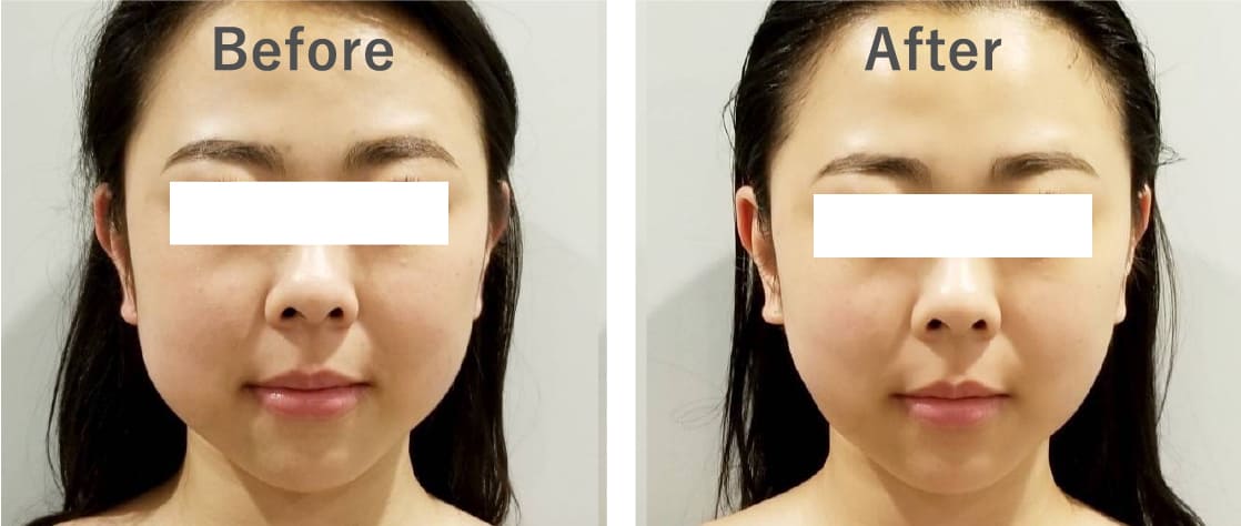 Before After