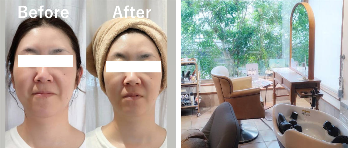 Before After