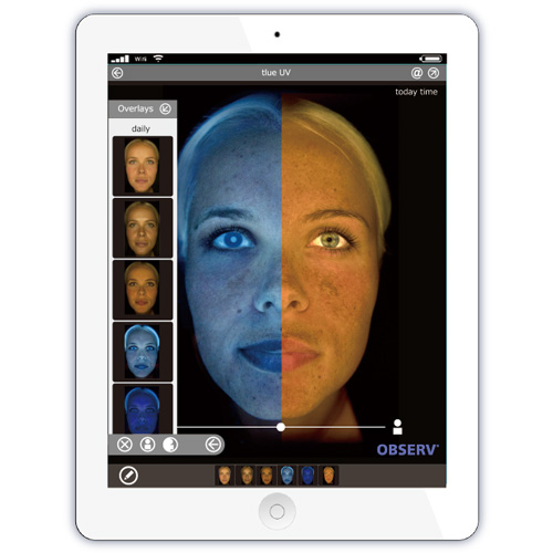 オブザーブ 肌診断機のイメージ画像