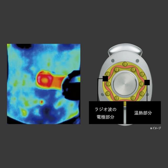 ヤーマン キャビスパプレステージ for Salonのイメージ画像