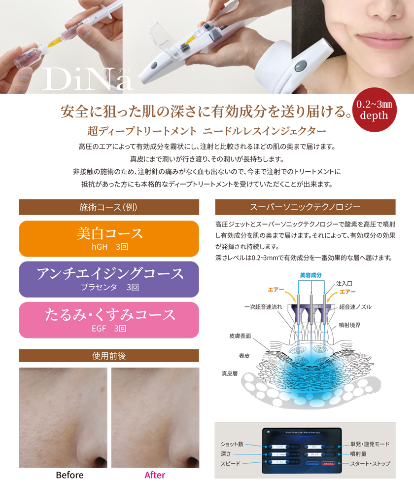 DiNa ニードルレス エアインジェクター フェイシャル美容器 業務用