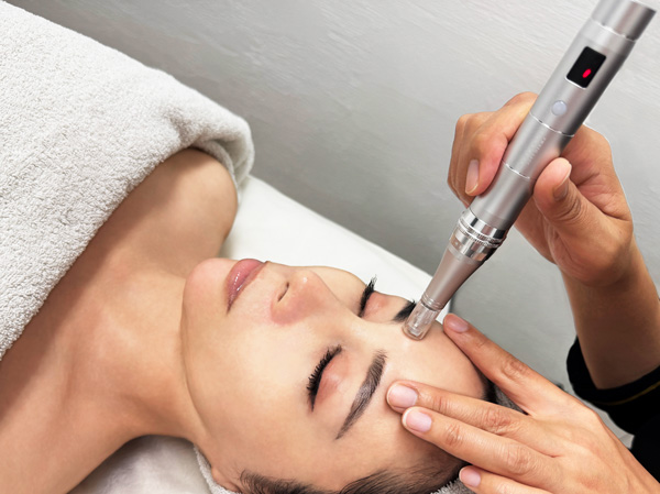 SOFT DERMA